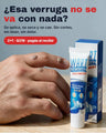 Wart Remover — Tratamiento 2x1 para verrugas (2 tubos de 20 g)